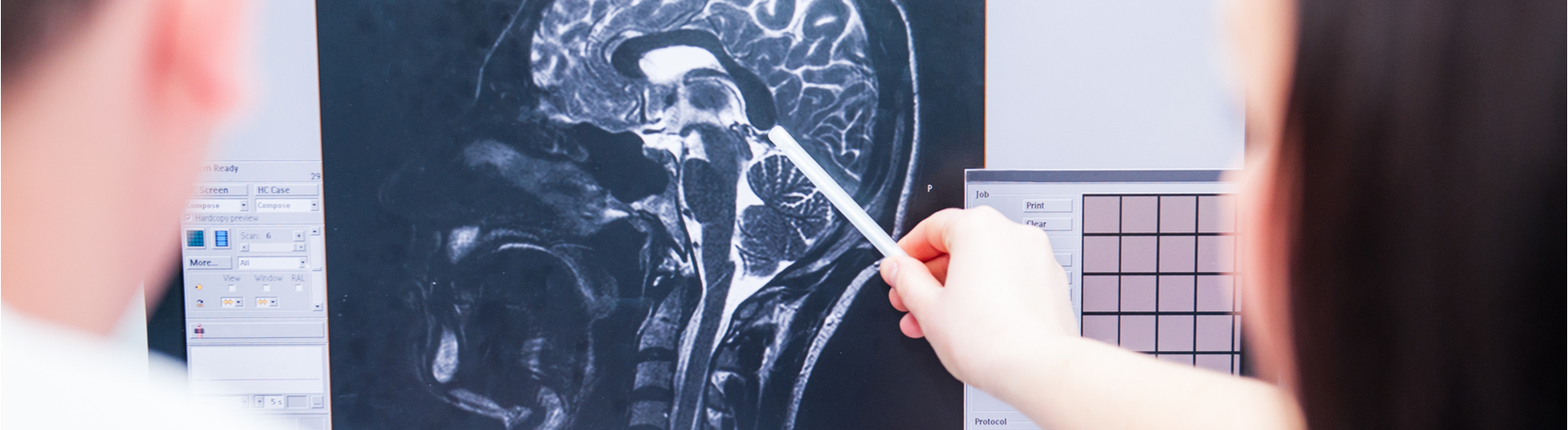 Brain Injury Compensation Claims